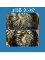 増毛エクステ専門店 エクステルーム 渋谷店(exteroom)&nbsp;白髪抜き60分