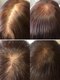 エメ(Aimer)の写真/【リピート続出！Aimerの増毛エクステ】トップはもちろん、顔周りや前髪などボリュームアップはお任せ◎