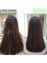 リメル 奥沢自由が丘店(Remel)&nbsp;話題の超音波トリートメント