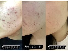 しっかり結果が出る！…大人気『CLALAシリーズ』