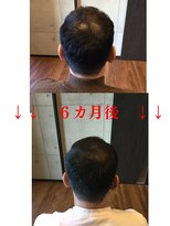 エルアスク 頭皮ケア