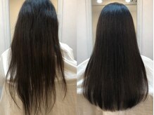 リフアクト(LifAct)