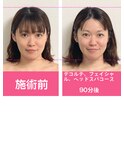 デコルテフェイシャルヘッドスパ