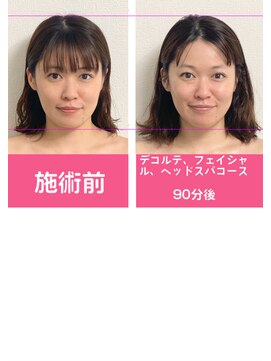 銀座ねむり姫 GINZA east店 デコルテフェイシャルヘッドスパ