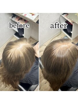 シュガー バイ エクラート 立川南口店(SUGAR by ECLART) 【髪質改善】白髪ぼかし【立川】