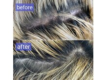 ネオフィリア 下井草店(NEO PHILIA)の雰囲気(ヘッドスパで保湿しながら血行促進して頭皮改善をしていきます)