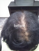 シャンディア(SHANDIA)&nbsp;ボリュームエクステ　　　白髪染め/頭皮改善/髪質改善