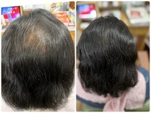 ヘアーアンドリラクゼーション シード(SEED)の雰囲気（育毛コーススタートしました！お写真3か月での結果です）