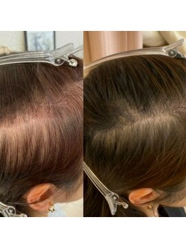 髪質改善 ソアリス 烏丸丸太町店(soiris) 頭皮改善エステ(細毛トリートメント)