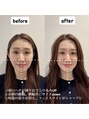 セラ(Cela)&nbsp;【骨格矯正スパ】身体の歪みを整え凝り改善＋中顔面短縮