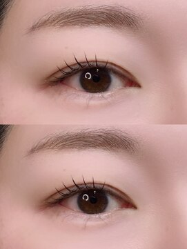 メルク ユニ(merc.uni) 小顔ラッシュリフト12.12