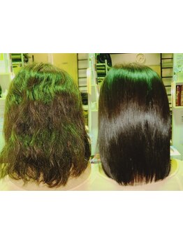 【Ｍ３Ｄ取扱】今までの常識が変わる!一度通えば違いが分かる豊富な経験から導いた技術で若々しい見た目に!