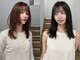 ヨーク(YOKE)の写真