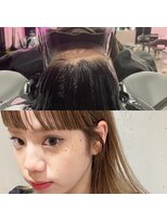 キジ(KIJI) 頭浸浴、頭皮改善、髪質改善、デトックスケア