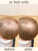 アールヘアノル(ar hair nolu)&nbsp;エイジングケアカラー 1