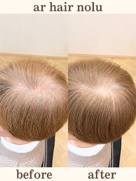 アールヘアノル(ar hair nolu) エイジングケアカラー 1