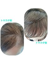 ユーフォルムギンザ(y-Forme Ginza)&nbsp;話題のトキカタ♪前髪編