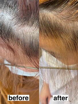 ミルシー(millci) 美髪整形前髪矯正