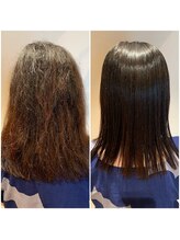 【施術事例/4０代女性M様】