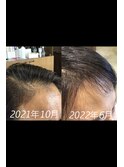 頭質改善ケア