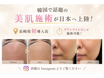 リベルテ(Liberte)の写真