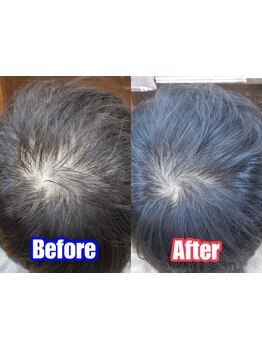 ≪育毛促進に特化したヘッドスパ≫髪の根元からハリ・コシのある美髪に!頭皮の汚れも落としてスッキリ