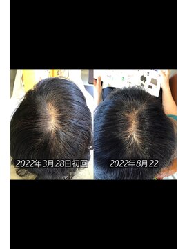 サーカス 銘苅店(circus) 頭質改善ケア