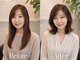 リビューティー アーク(RE:BEAUTY A)の写真