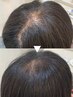 エイジング髪悩みに＜ヒト幹細胞50％＋髪質改善トリートメント＞￥14000