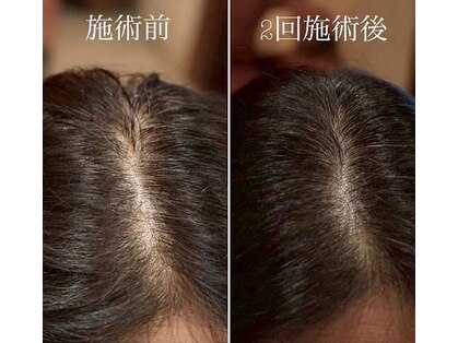 ライムヘアービューティフィー(Lime hair beautify)の写真