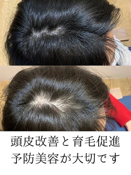 ジェントラ(Jentra) 予防美容　ヘアサロンジェントラ　亀戸店