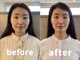 カミベヤ(KAMIBEYA)の写真/35歳からのエイジングケア◎骨格の歪みを改善し、血行を促すことで髪も頭皮も健康的にリフレッシュ♪