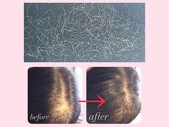 増毛エクステ専門店 エクステルーム 渋谷店(exteroom)の写真/話題沸騰【白髪抜き30分￥3200】【増毛エクステ100本￥2700】40代男性に大人気の若見えサロン☆