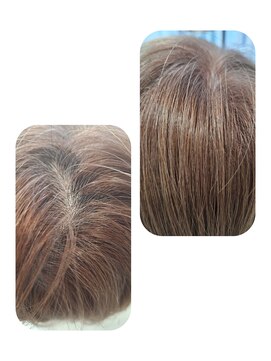 ユーフォルムギンザ(y-Forme Ginza) 話題のトキカタ♪頭頂部編