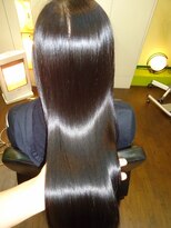 エムスリーディーミュゼステージ(M3D)&nbsp;２回目のピコトリートメント