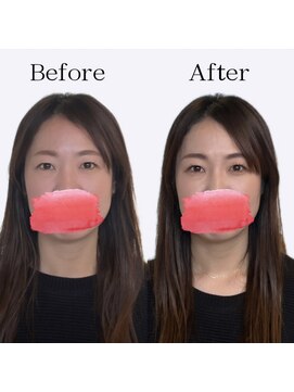 レトア(Letoa) ビフォーアフター