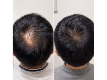 ライフステージ(Life Stage)の雰囲気（頭皮や髪の毛のお悩みならお任せください！）
