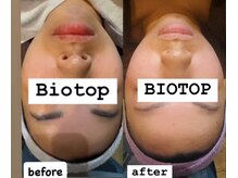 ビオトープ(BIOTOP)