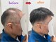 ラソヘアー(Lazo hair)の写真