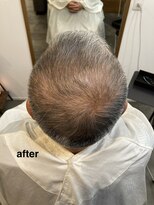 テール(TERRE) 【年齢とともに変わる髪質…それ、“頭皮と骨格”が原因かも】