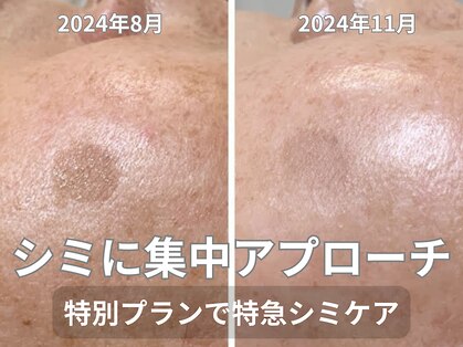 ネヅの写真