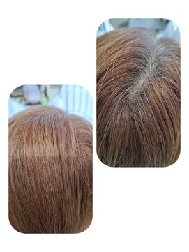 ユーフォルムギンザ(y-Forme Ginza) 話題のトキカタ♪頭頂部編