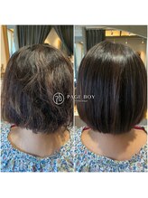 【施術事例/5０代女性U様】