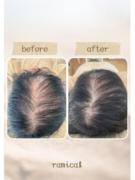 ラミカル(ramical) 分け目の透け感にヘアループエクステ