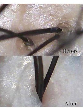 グロウズ(GROW’S) 地肌改善ヘッドスパ