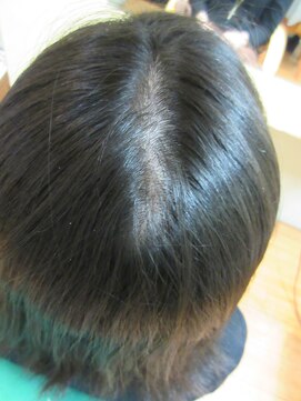 ヨシユキコンディショニング エイジレス　特許「つむじ補正」　つむじ、分け目が目立つ方４５