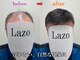 ラソヘアー(Lazo hair)の写真