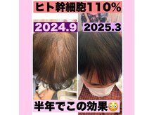 モエちょき