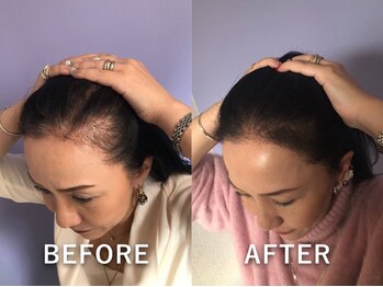 グレースフィオーレ 苫小牧店の写真/高濃度ヒト幹細胞培養上清液×育毛促進に特化した本格ヘッドスパのＷ施術で他では体験できない育毛促進ケア