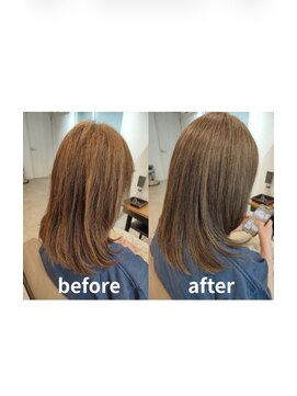 エイジングケア